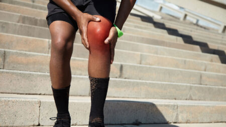 Artrosinovite del ginocchio